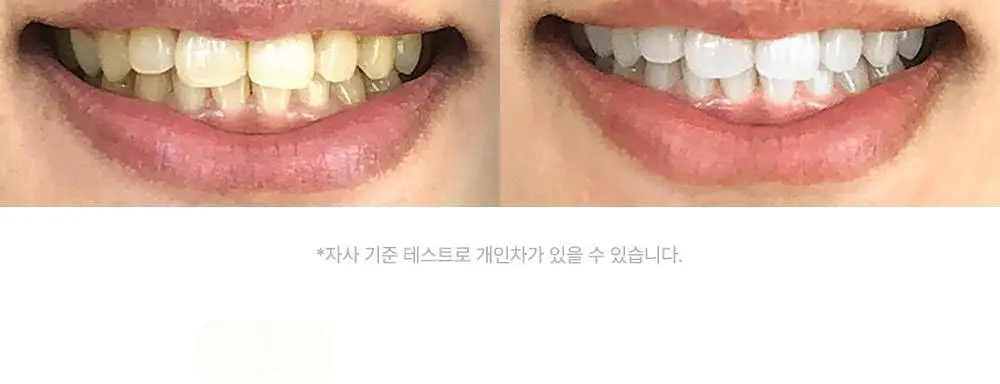 [치아미백] 칸디데 화이트케어 치약 100g 상세페이지 14
